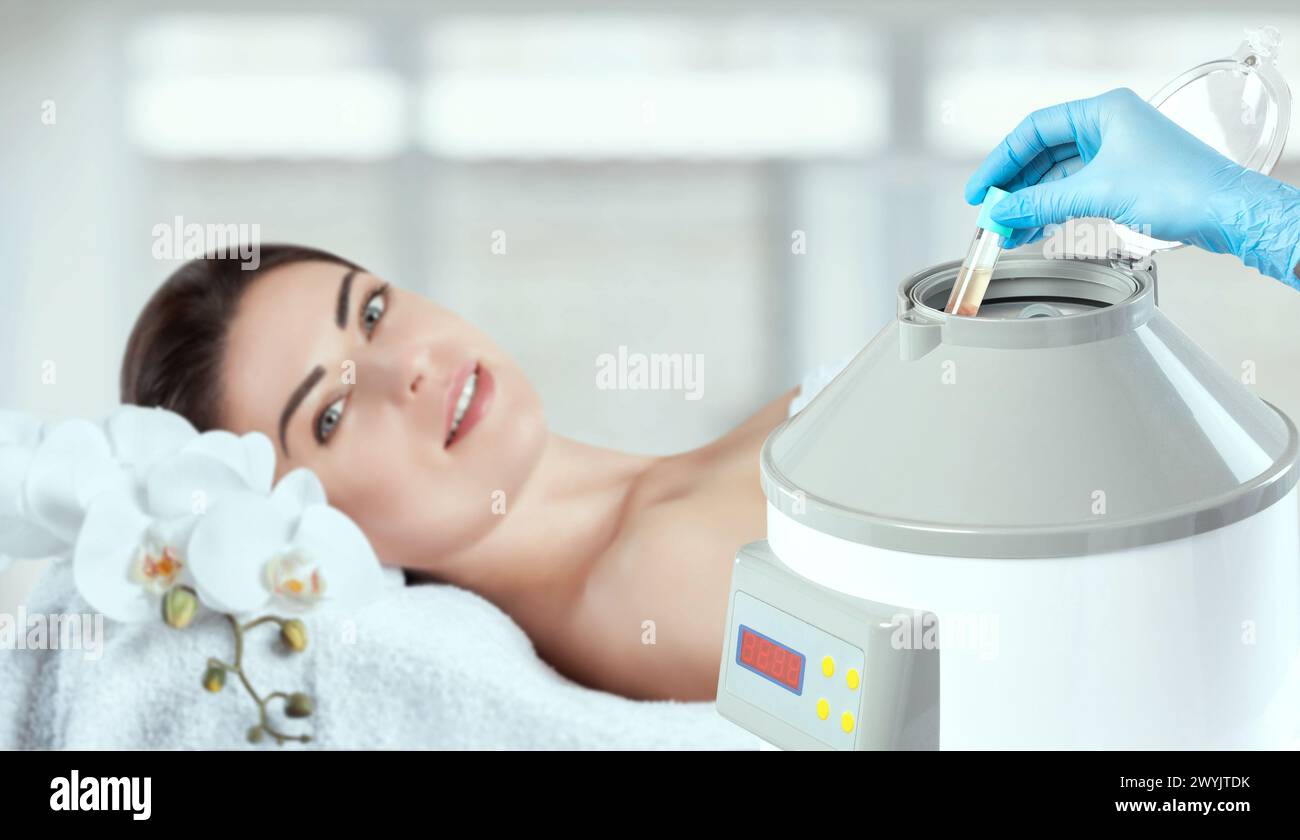 The blood tube is removed from the medical centrifuge for plasma lifting. Prp procedure. Stock Photo