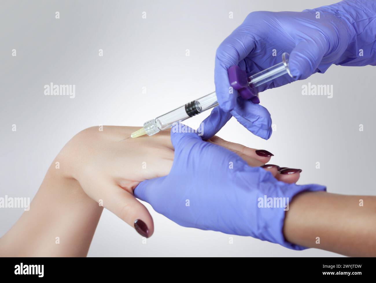 The doctor is making intramuscular injections of botulinum toxinon ...