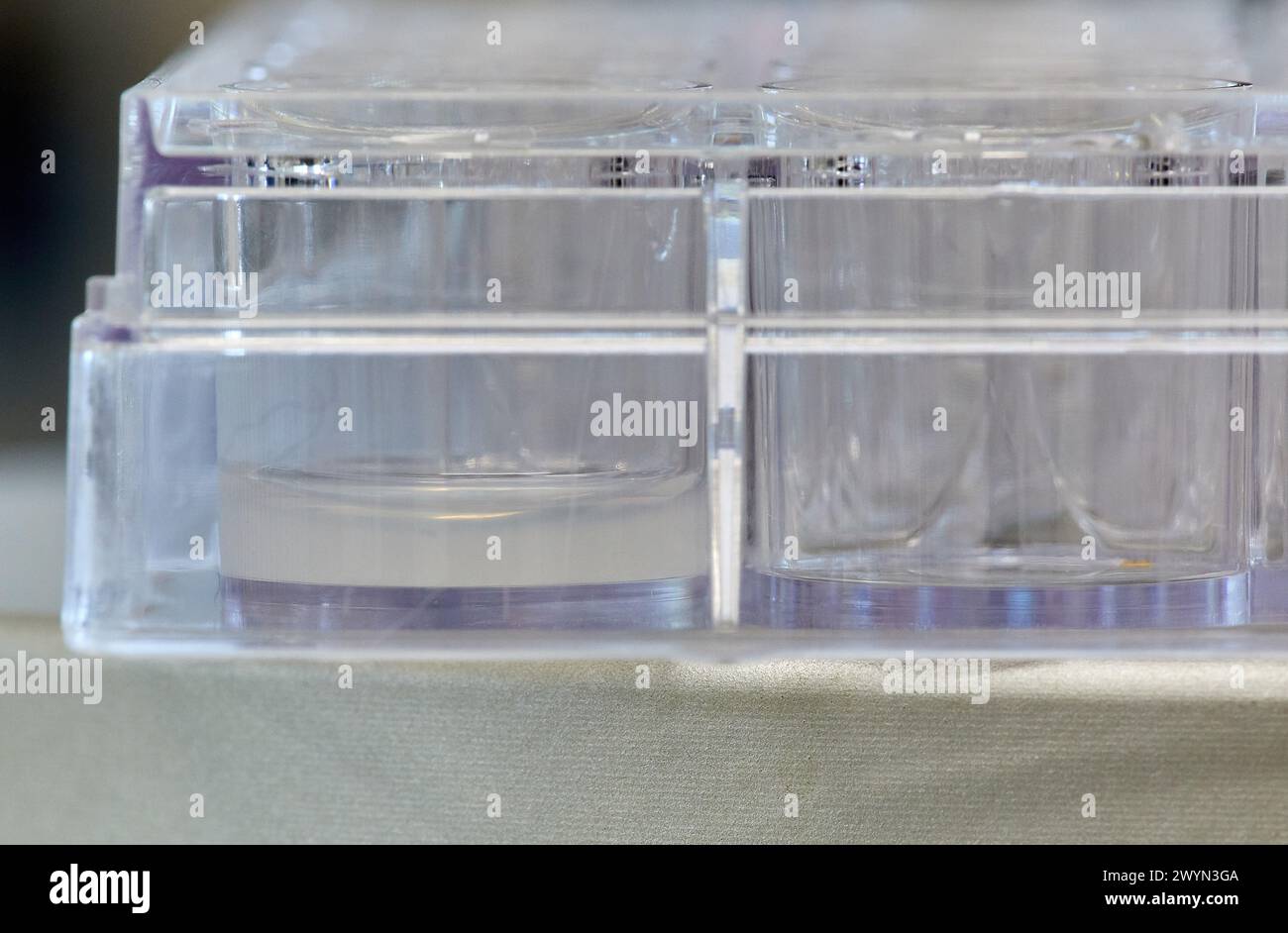 Fatrix FATRIX, Decellularized regenerative matrix oriented to the treatment of ...