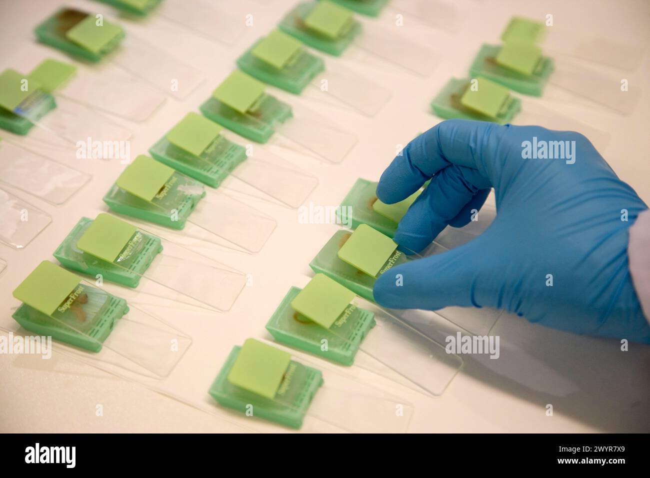 Microscope slides, Laboratory of Pathological anatomy, Departamento de ...