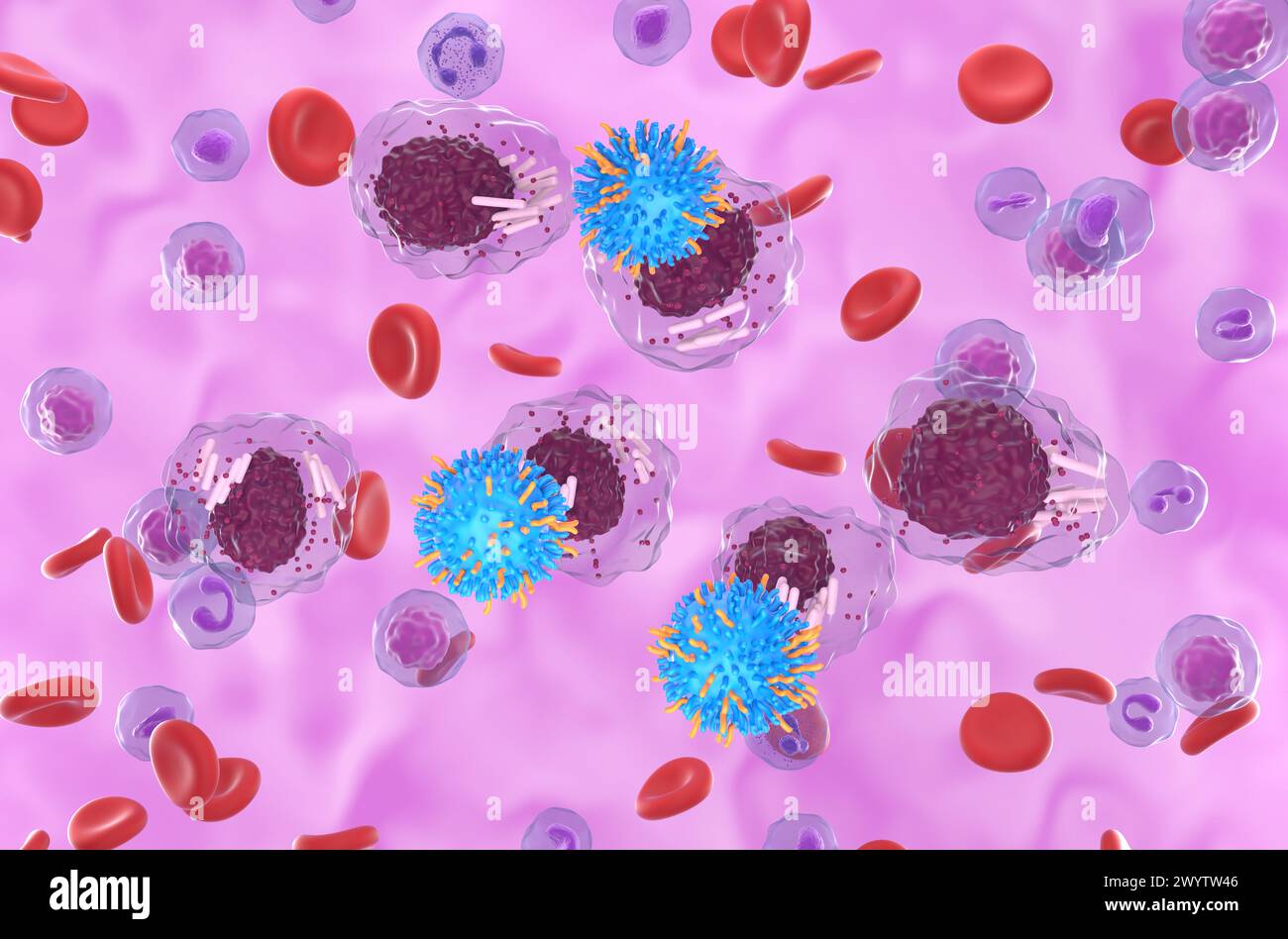 CAR T cell therapy in Chronic lymphocytic leukemia (CLL) - isometric view 3d illustration Stock Photo