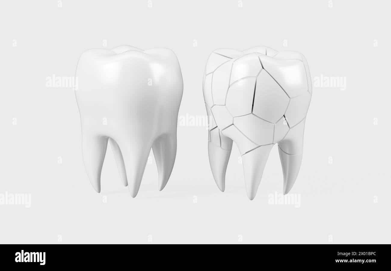 Human tooth model, tooth cracking, oral rehabilitation, 3d rendering. 3d illustration. Stock Photo