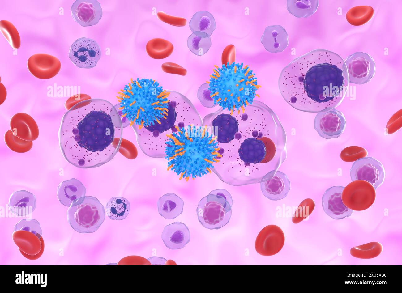 CAR T cell therapy in Multiple myeloma (MM) - isometric view 3d illustration Stock Photo