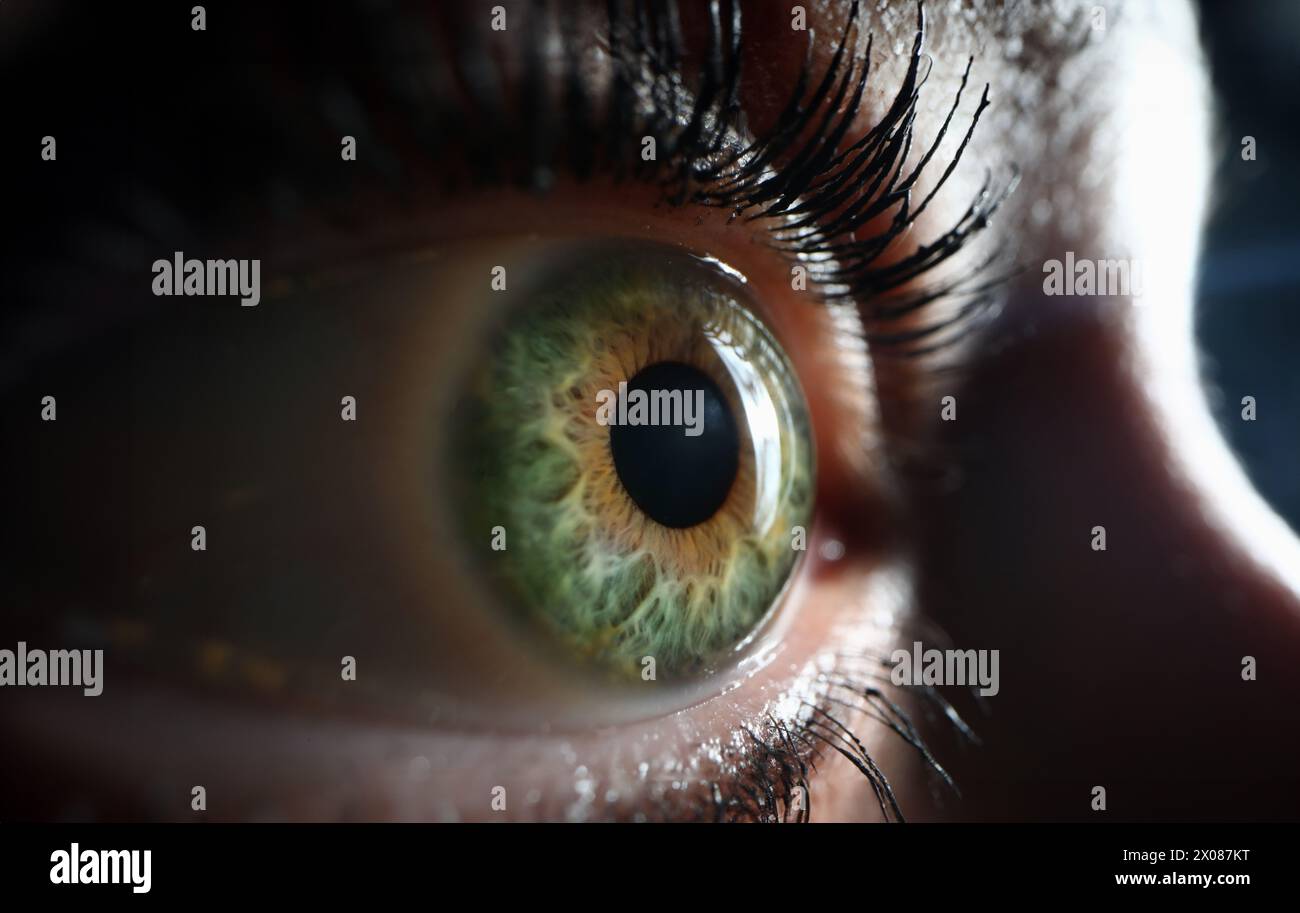 Female one green gray eye closeup. Farsightedness myopia Stock Photo