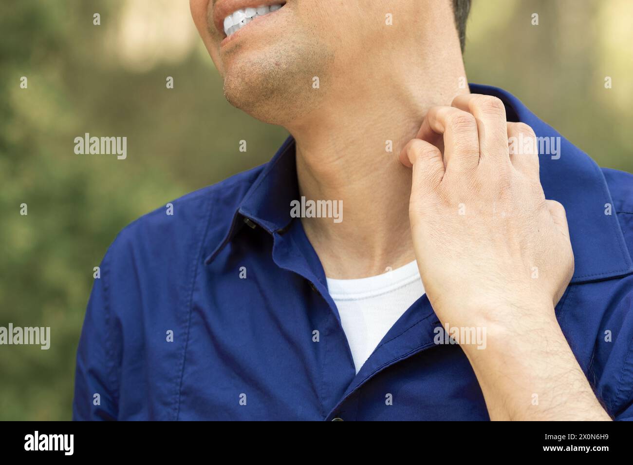 neck rash from dress shirt Why Do I Have a Rash on My Neck?