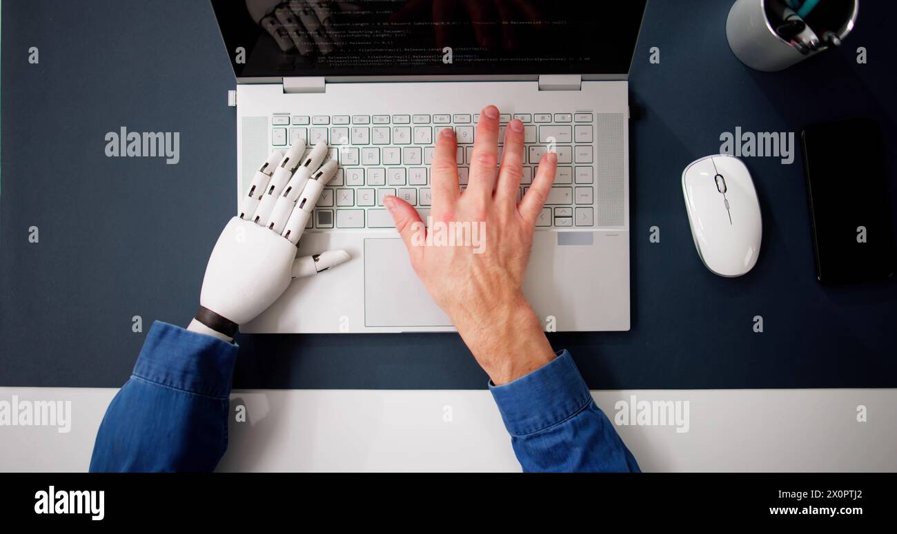 Man With Prosthetic Hand Working On Laptop. Artificial Limb Stock Photo