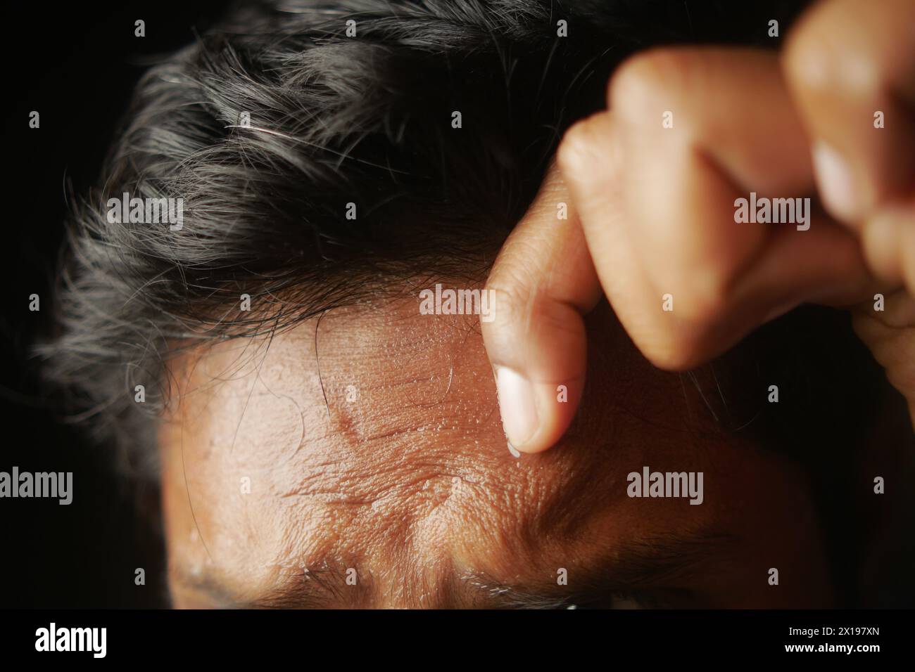 closeup of sweat on forehead against dark background , Stock Photo
