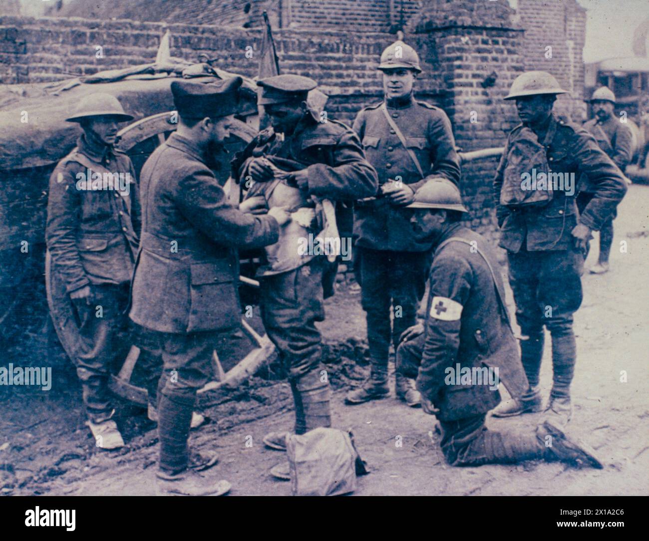 French doctor tending a wounded British soldier during WW1, France 1918 Stock Photo