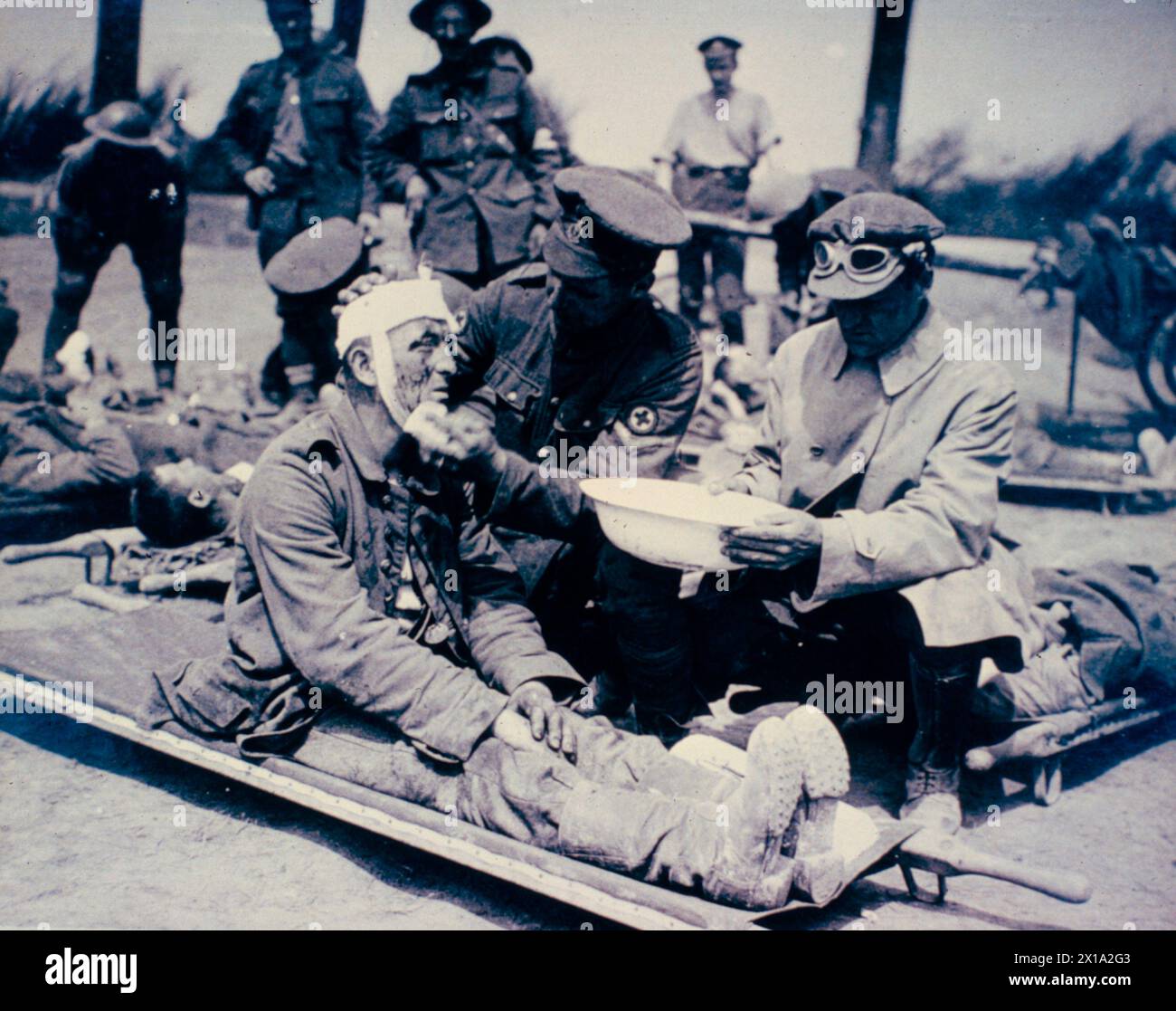British doctors tending a wounded German soldier, France WW1 1916 Stock Photo