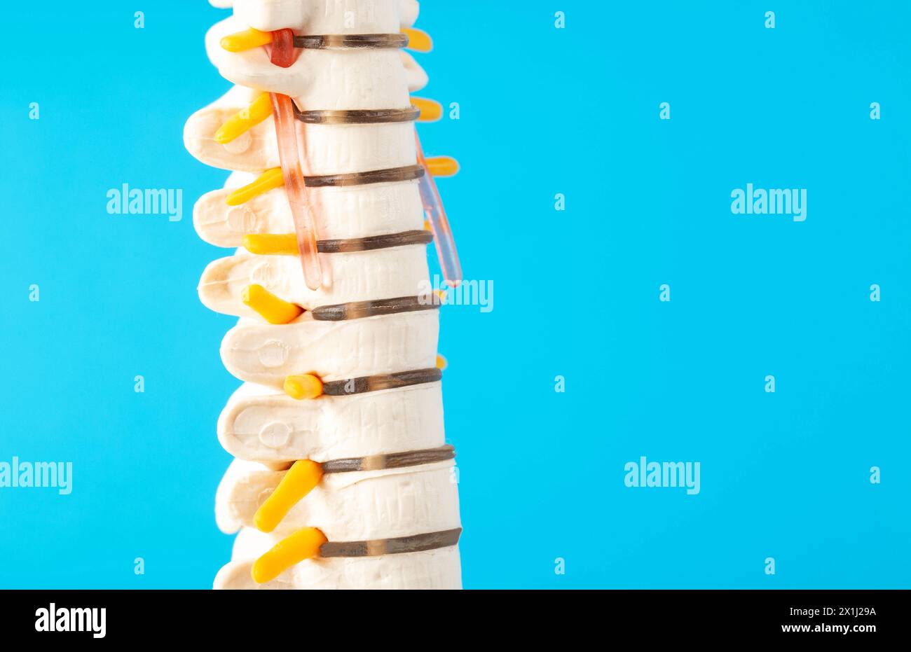 Mockup of the cervical spine on a blue background. The concept of health and treatment of spinal diseases, osteochondrosis and intervertebral disc her Stock Photo