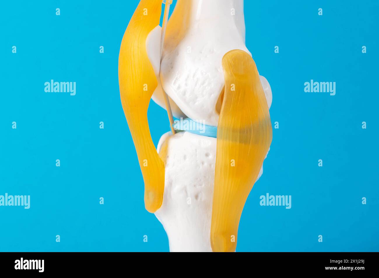 Medical mockup of the knee joint on a blue background, close-up. Concept of knee treatment with arthroscopic surgery. Knee replacement, prosthesis Stock Photo