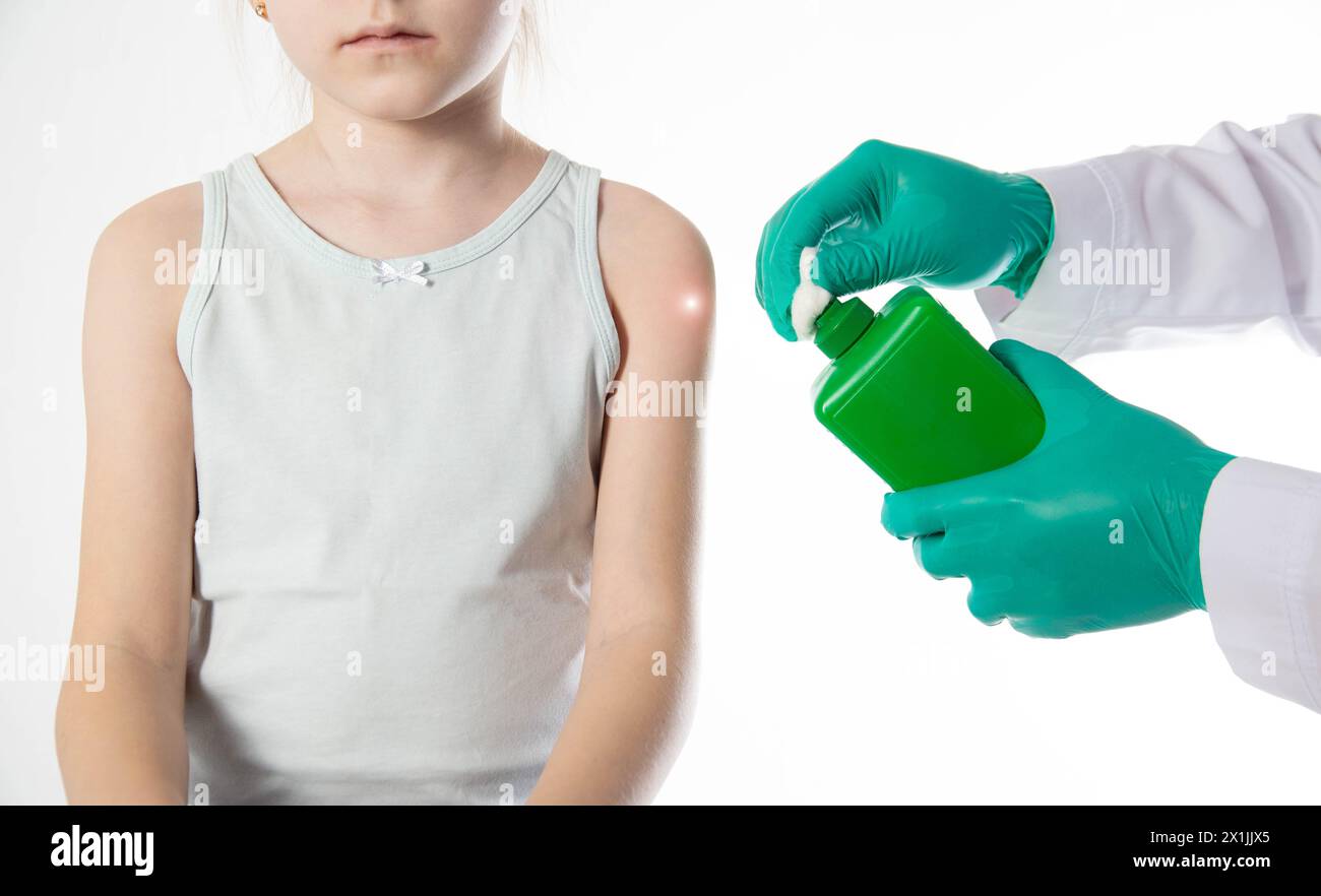 Doctor's hands with cotton wool and antiseptic treating the skin before vaccination against tetanus and viral hepatitis. Revaccination of children. Stock Photo