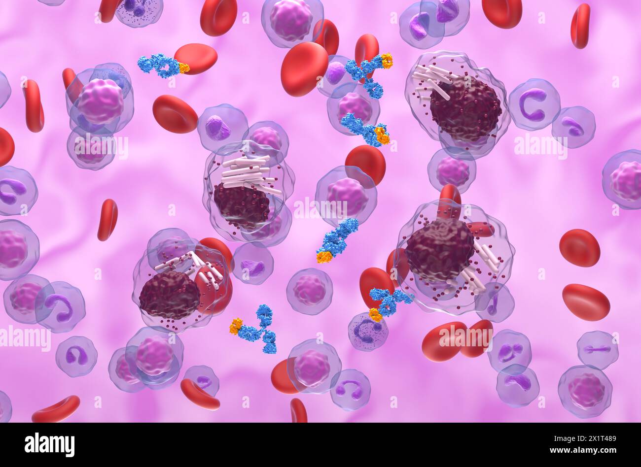 Monoclonal antibody treatment in Chronic lymphocytic leukemia (CLL) - isometric view 3d illustration Stock Photo