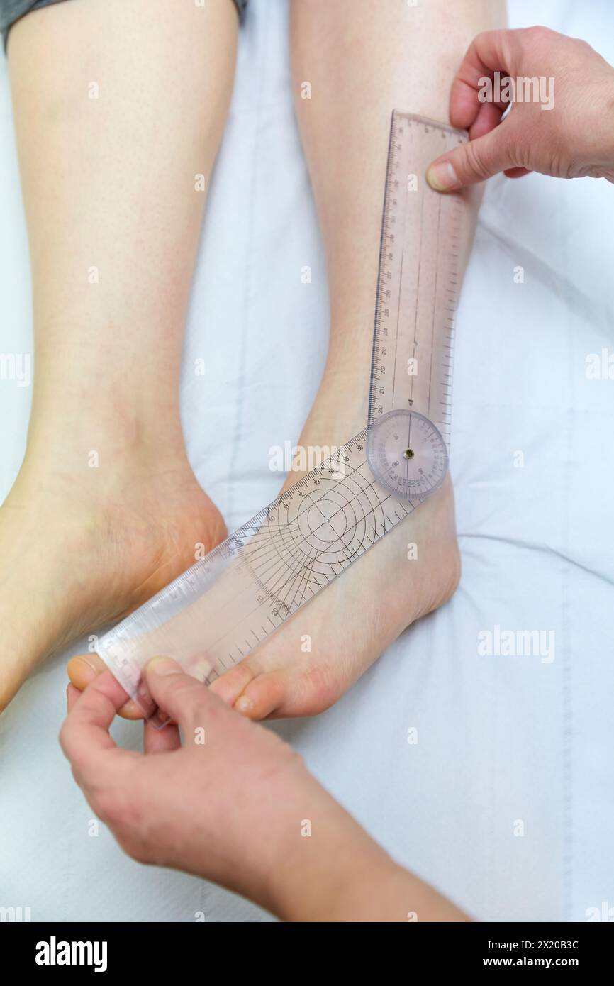 Doctor with goniometer measuring ankle inversion, Physiotherapy medical center, Donostia, San Sebastian, Gipuzkoa, Basque Country, Spain. Stock Photo
