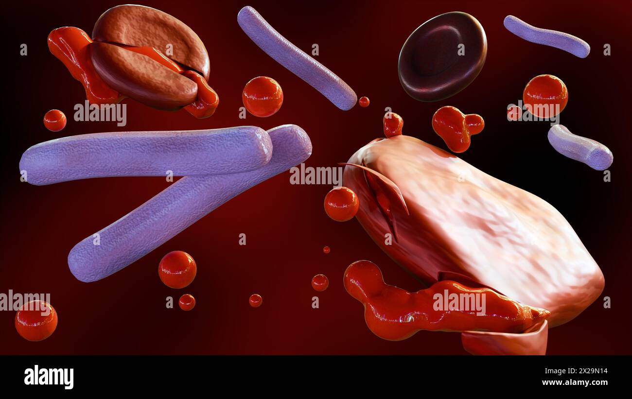3d rendering of Septicemia, or sepsis, is the clinical name for blood poisoning by Klebsiella spp. bacteria. Stock Photo