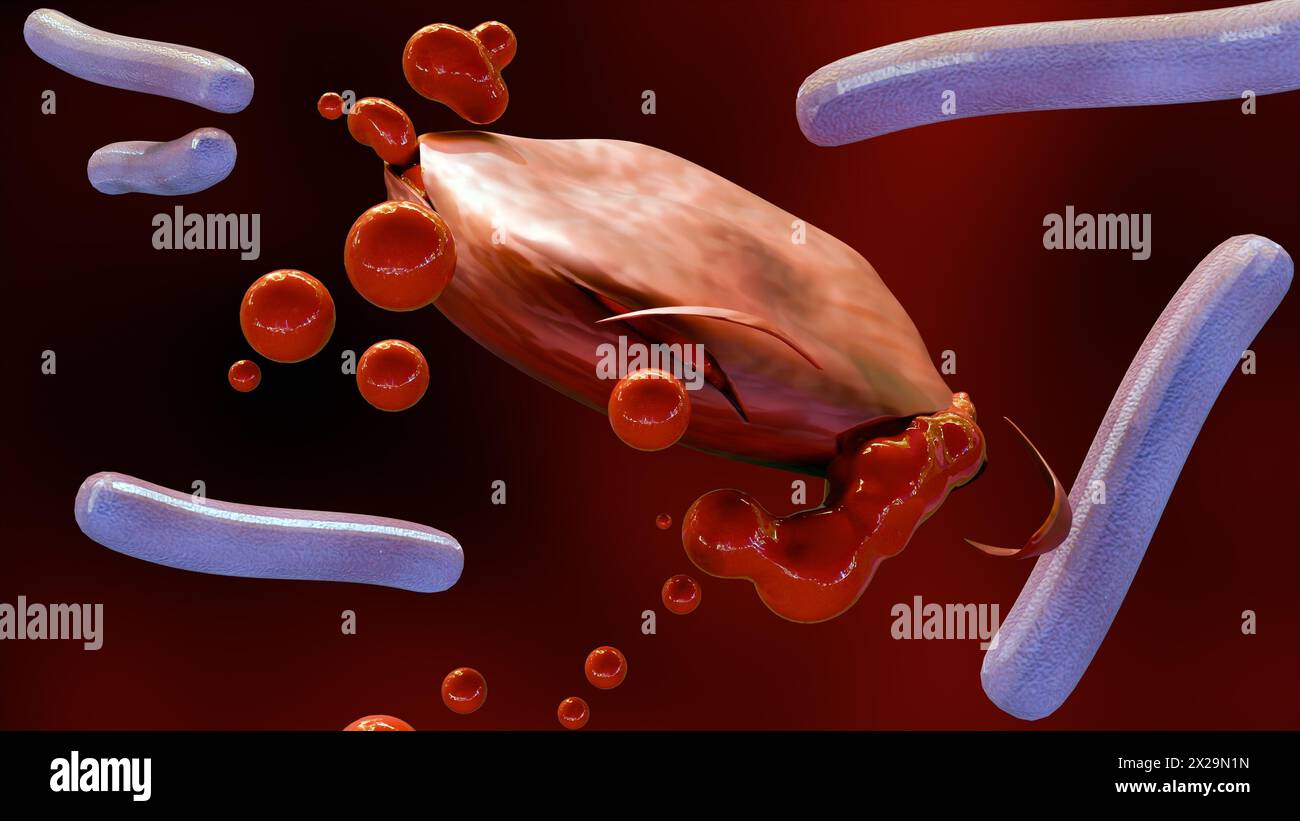 3d rendering of Septicemia, or sepsis, is the clinical name for blood poisoning by Klebsiella spp. bacteria. Stock Photo