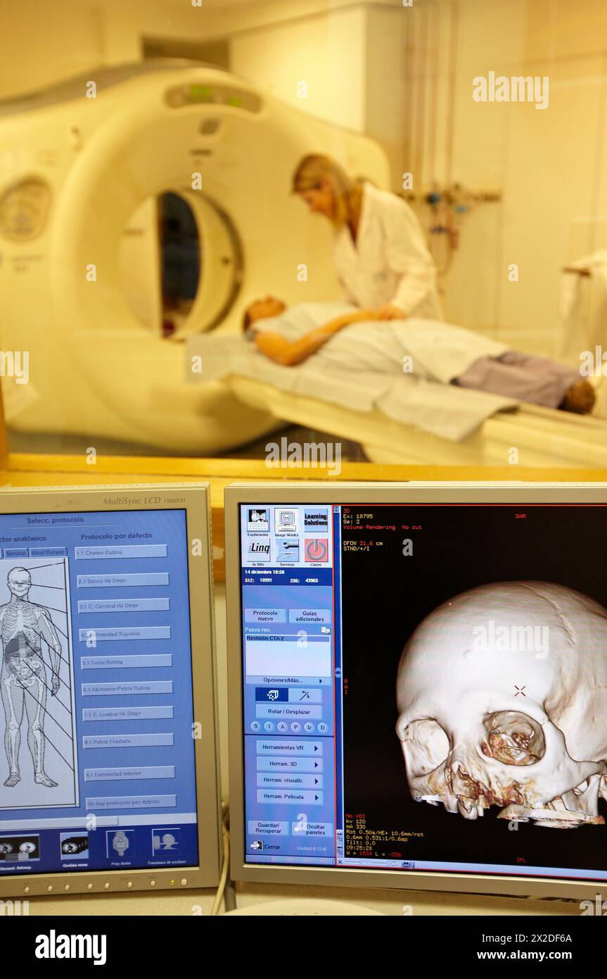Cranium, CAT (Computerized Axial Tomography) scan, Radiology, Medical imaging for diagnosis. Hospital Policlinica Gipuzkoa, San Sebastian, Donostia, E Stock Photo