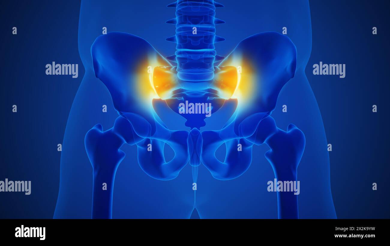 Anatomy concept of an arthritic sacroiliac joint Stock Photo