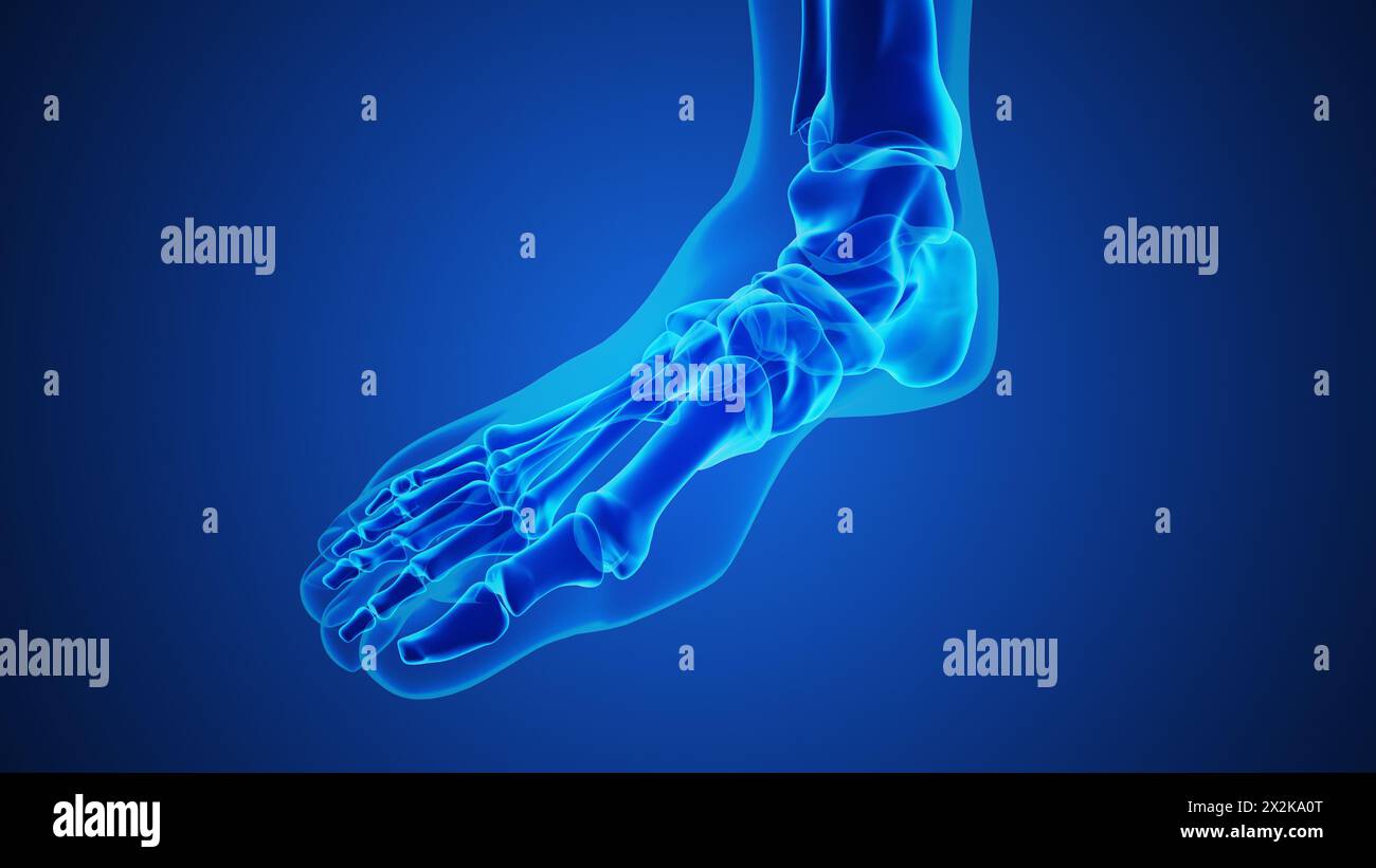 Painful gout inflammation on big toe joint Stock Photo
