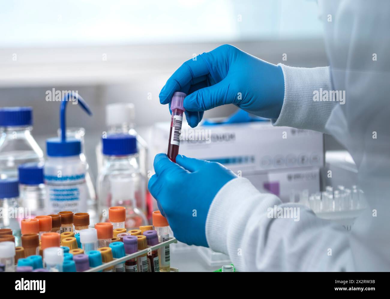 Scientist holding blood sample tube in laboratory Stock Photo