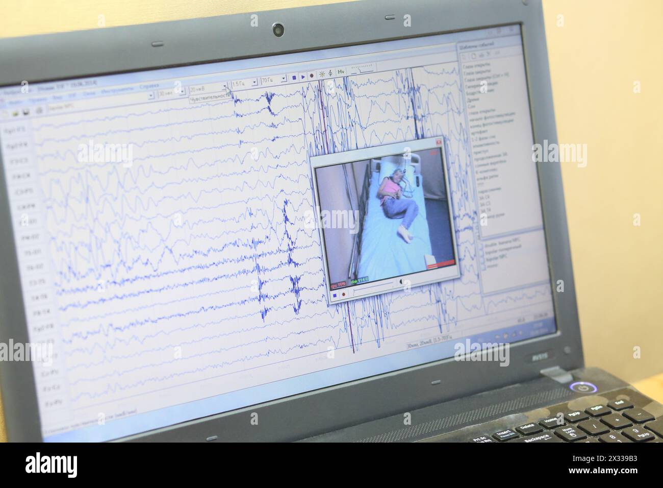 Laptop screen with a program for recording the results of the