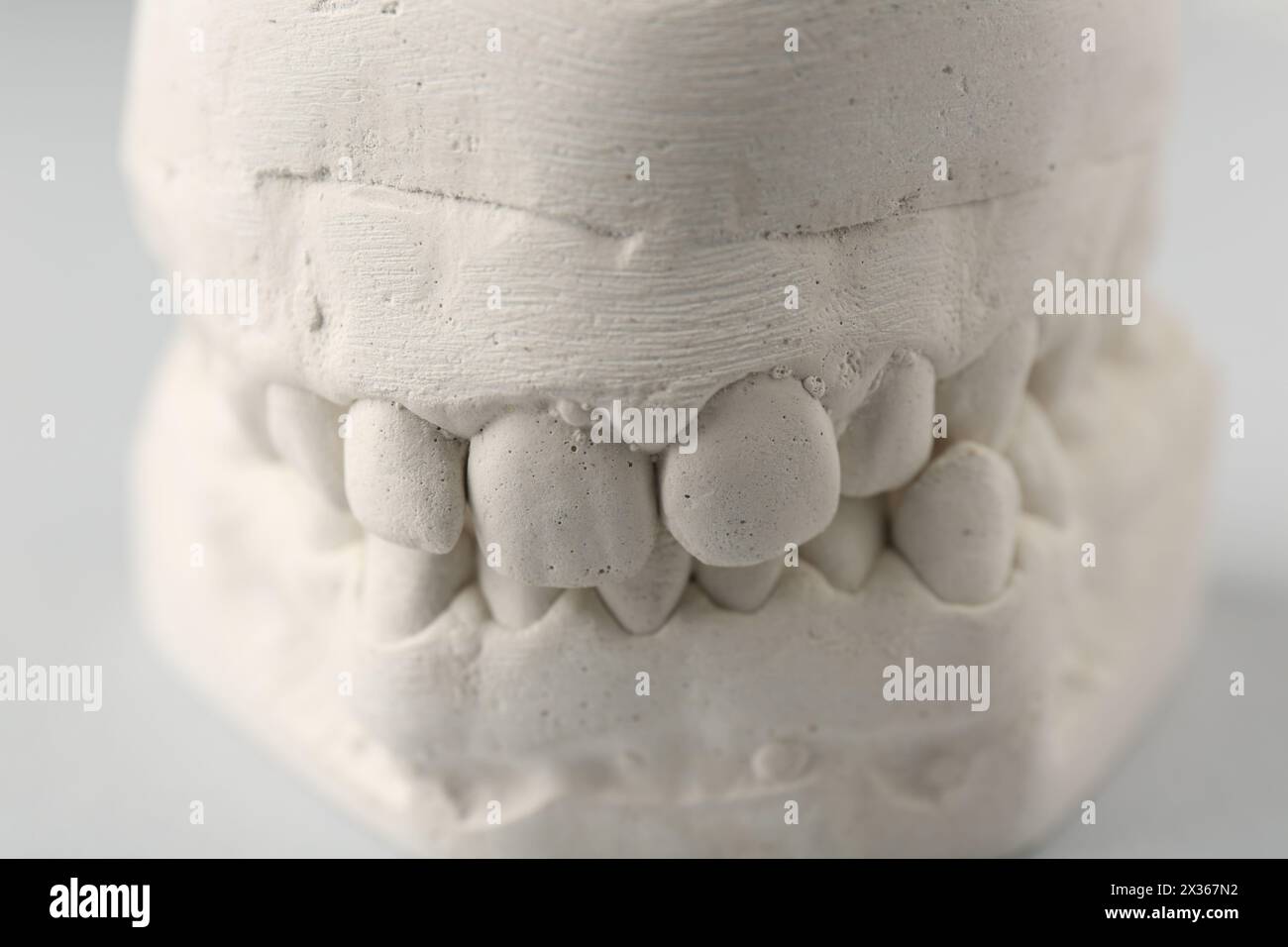 Dental model with gums on light grey background, closeup. Cast of teeth