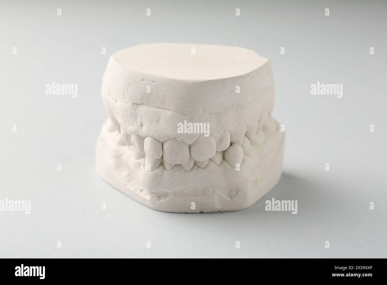 Dental model with gums on light grey background. Cast of teeth Stock