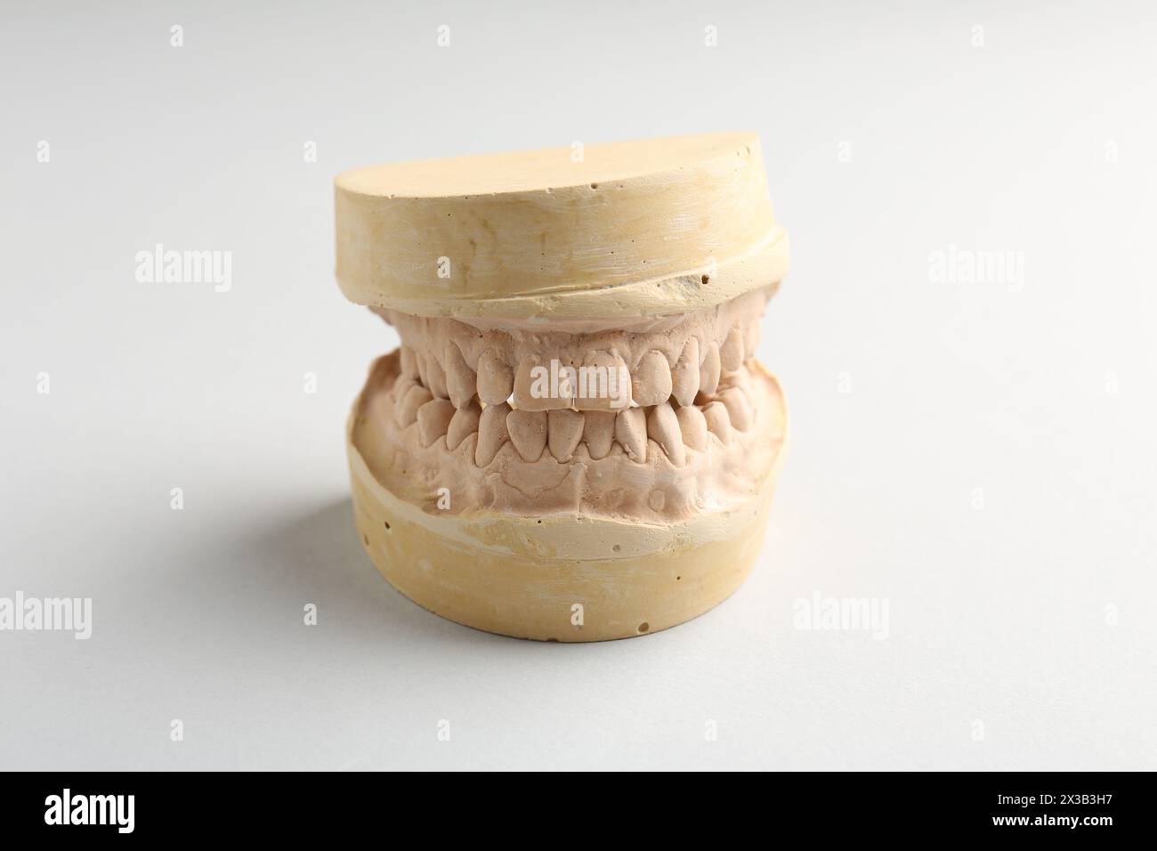 Dental model with gums on light grey background. Cast of teeth Stock