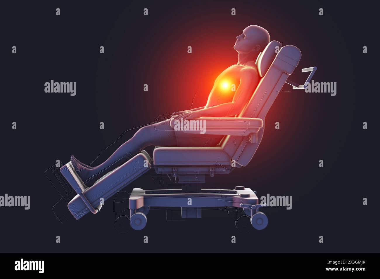 Illustration depicting a male patient on a medical wheel experiencing heart pain, conveying the urgency of cardiovascular distress. Stock Photo