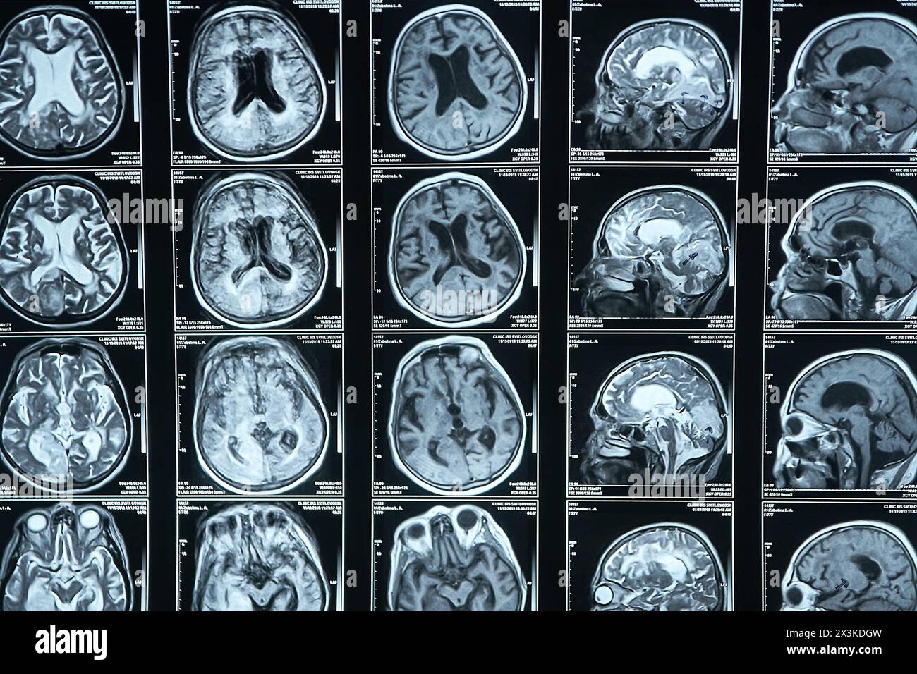 MRI images of the brain show different slices and structures of the ...