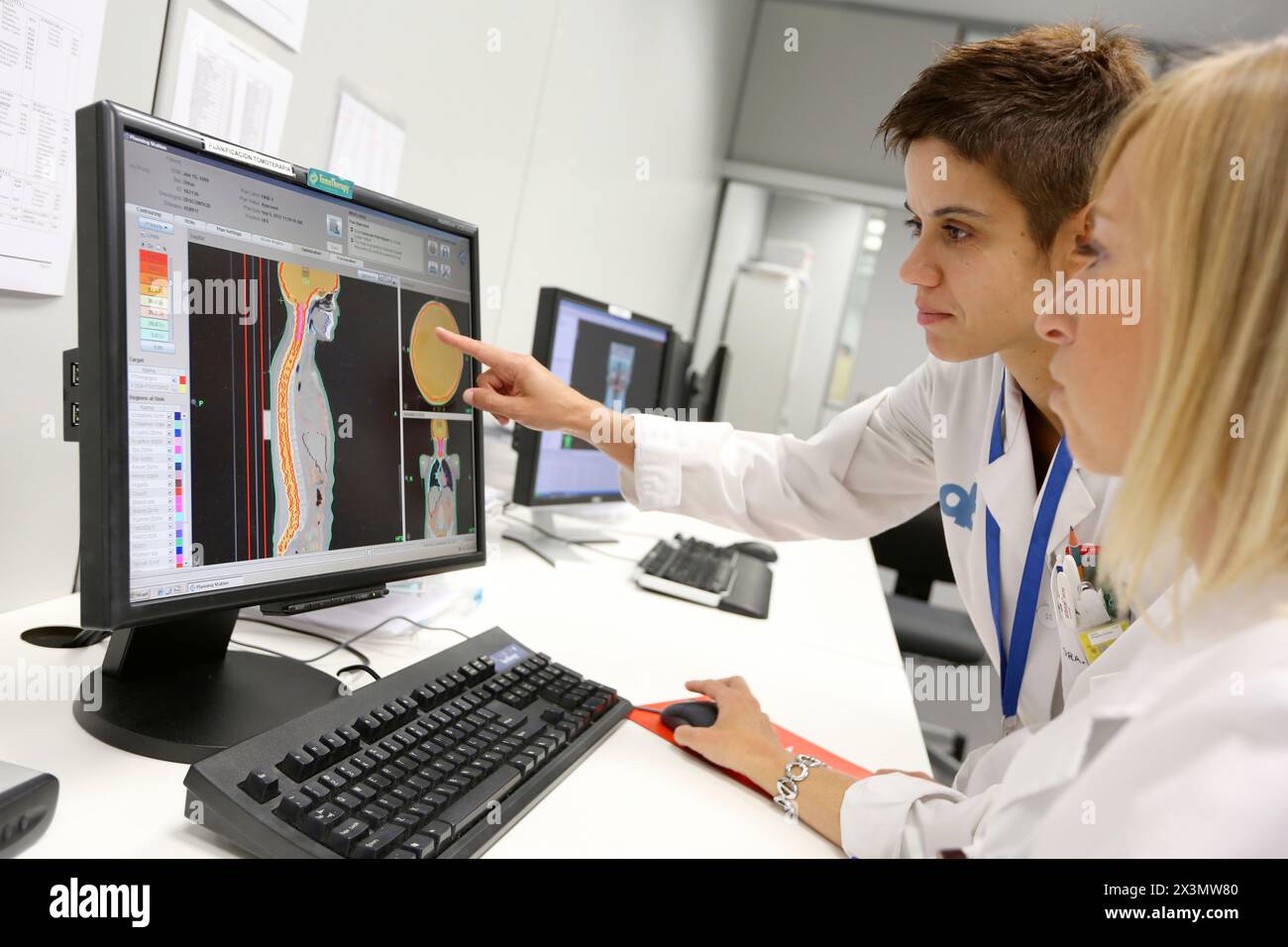 Treatment craniospinal and ORL with IMRT Intensity Modulated Radiation Therapy, Medical physics, radiation treatment application, imaging, Onkologikoa Stock Photo