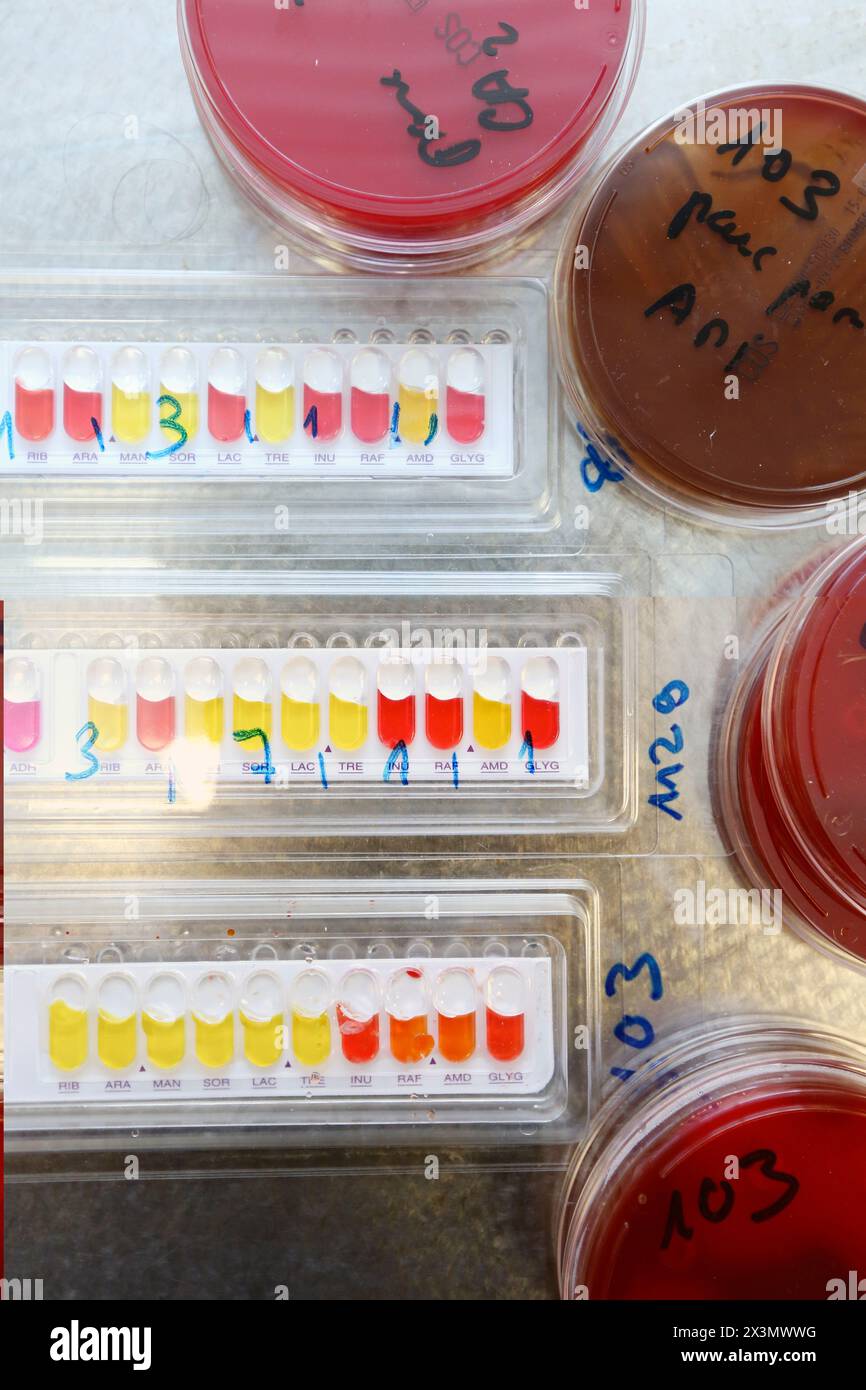 API Microbiology test, Identifying bacteria Laboratory technician API Microbiology test, Identifying bacteria Laboratory technician