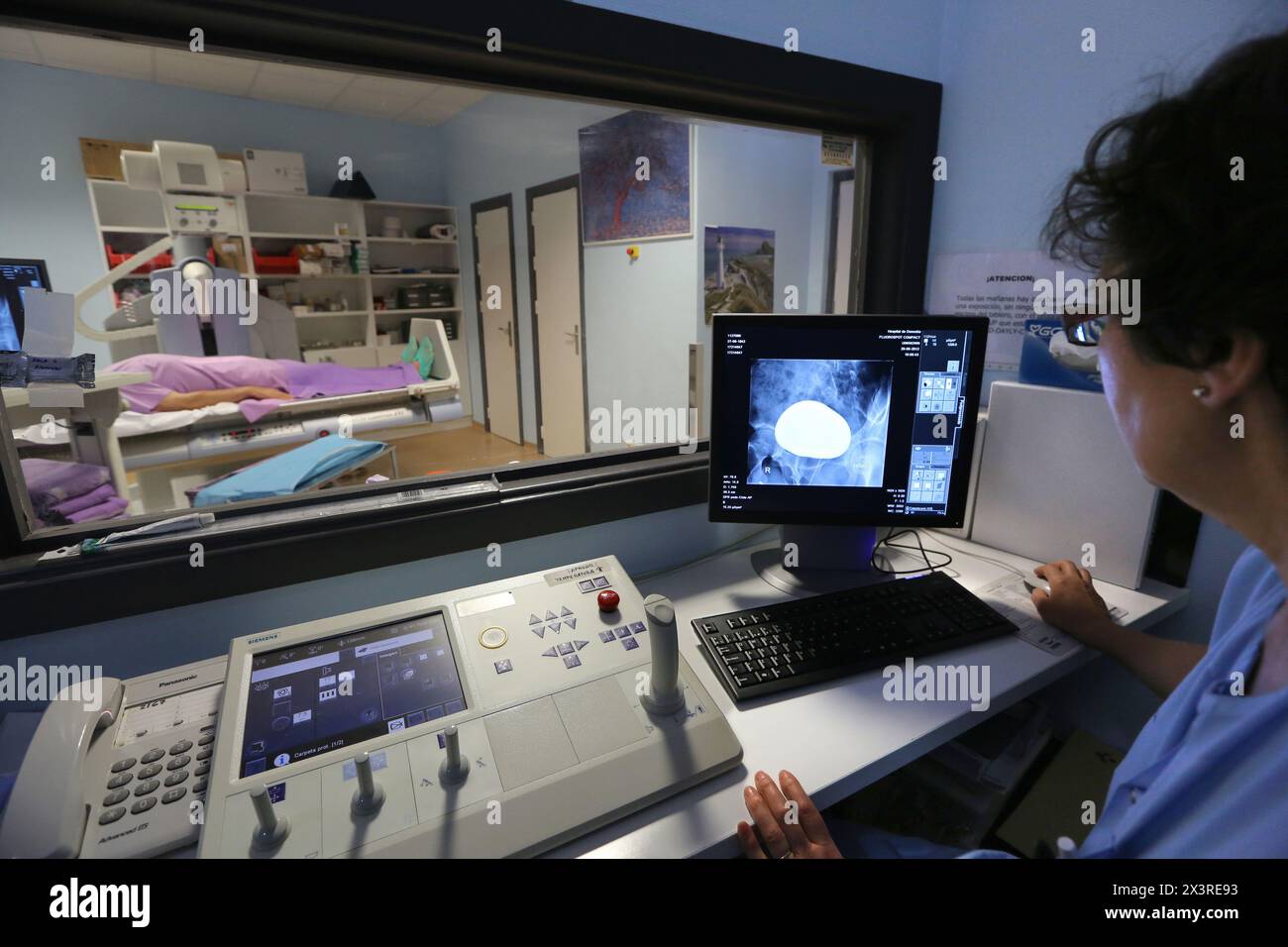 Cystography, X-ray, Contrast studies, Radiology Department, Donostia Hospital, San Sebastian, Donostia, Gipuzkoa, Basque Country, Spain Stock Photo