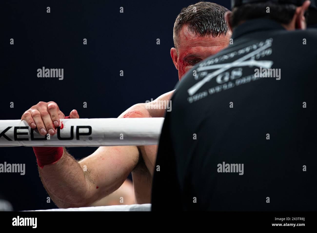 Cody Vidal gets looked at by the referee to see if his eye which is gushing blood if ok to continue the fight. Bare Knuckle Fighting Championship (BKFC) makes its Los Angeles debut at the Peacock Theater, hosting 'Knucklemania' with Mike Perry vs.Thiago Alves headlining the event. Known as the fastest growing Combat Sports Promotion in modern times, BKFC has brought in the attention of many, including important figures to the fighting community such as Conor Mcgregor who has just become part owner of the quickly growing sport. Stock Photo