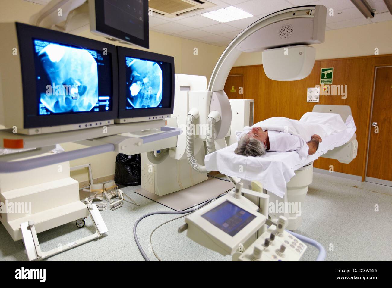 Contrast radiography of the digestive system, medical imaging for diagnosis. Hospital Policlinica Gipuzkoa, San Sebastian, Donostia, Euskadi, Spain Stock Photo