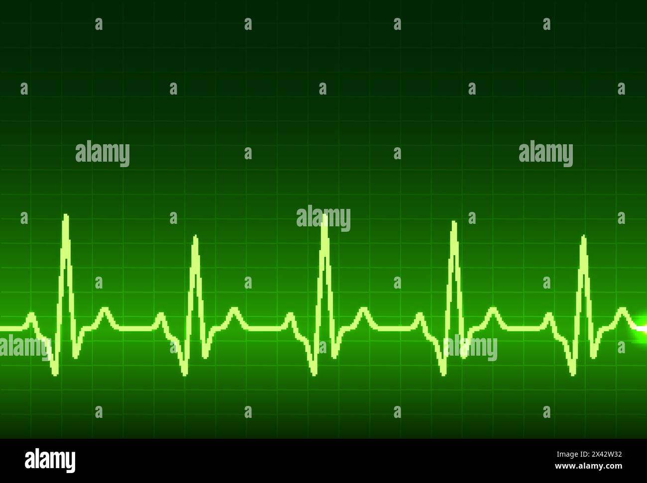 ECG heartbeat monitor, cardiogram heart pulse line wave. Electrocardiogram medical background. Stock Vector