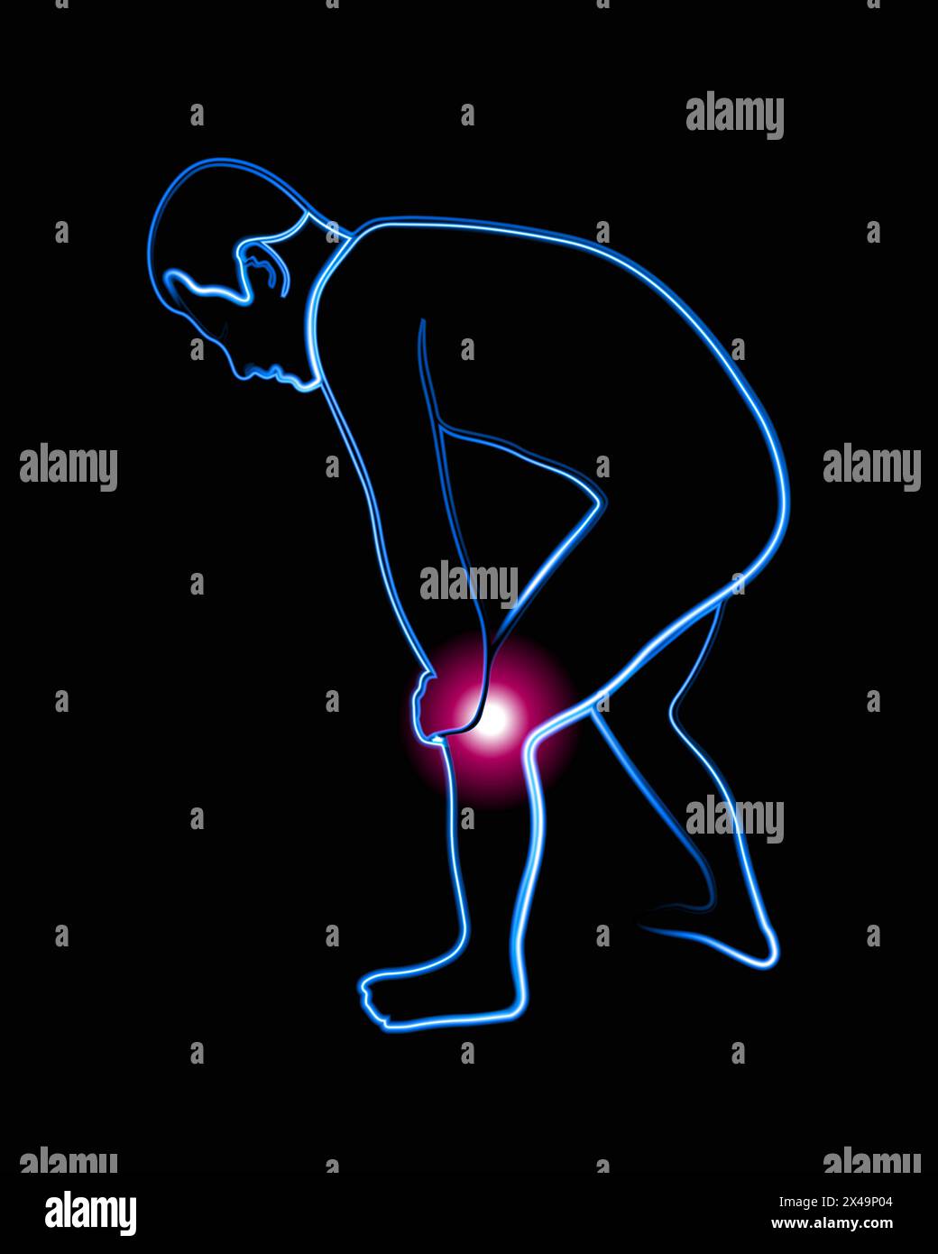 Runner In Pain Stock Vector Images Alamy poor-things-20th-century-studios-australia-new-zealand