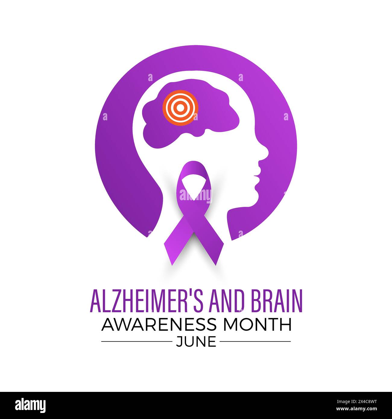 Alzheimer