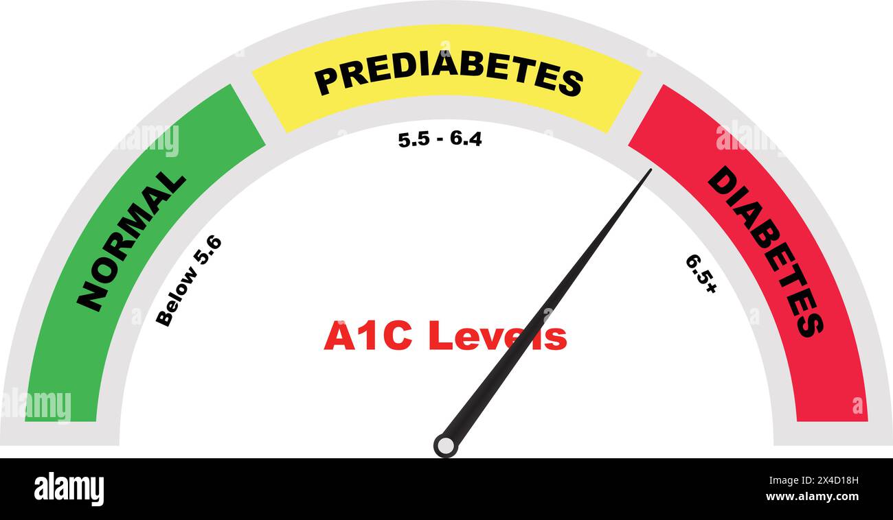 High diagnosing prediabetes hi-res stock photography and images - Alamy