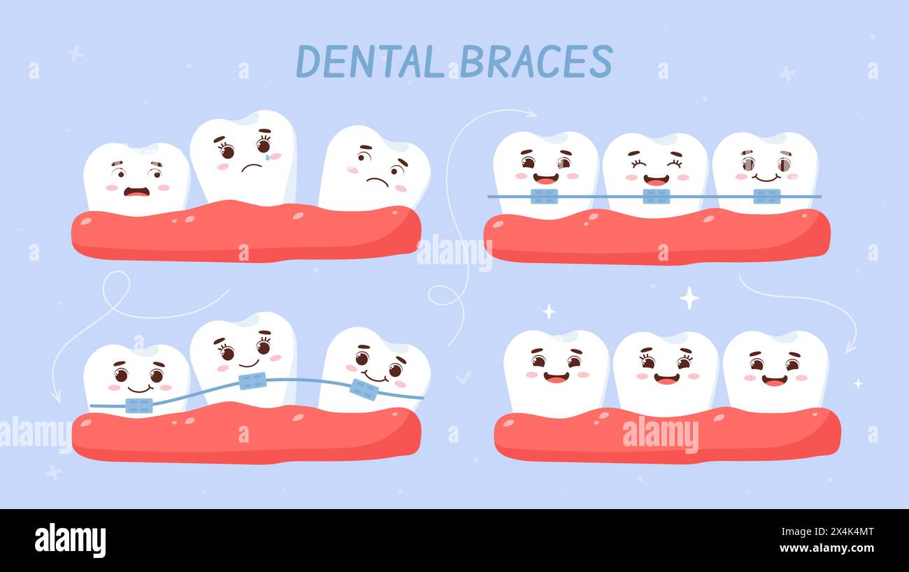 Dental braces vector set Stock Vector Image & Art - Alamy