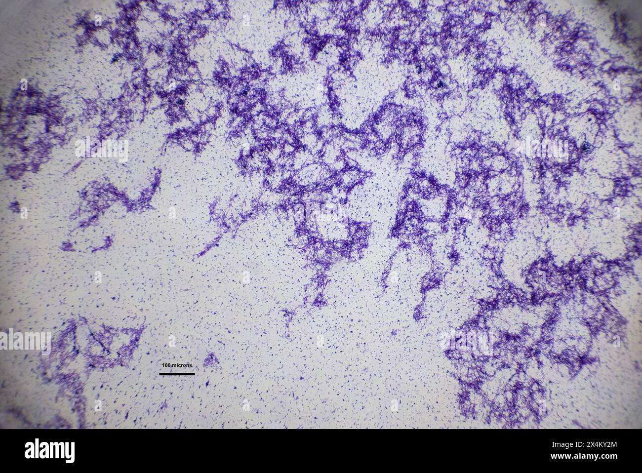 bacteria cells under a microscope Stock Photo