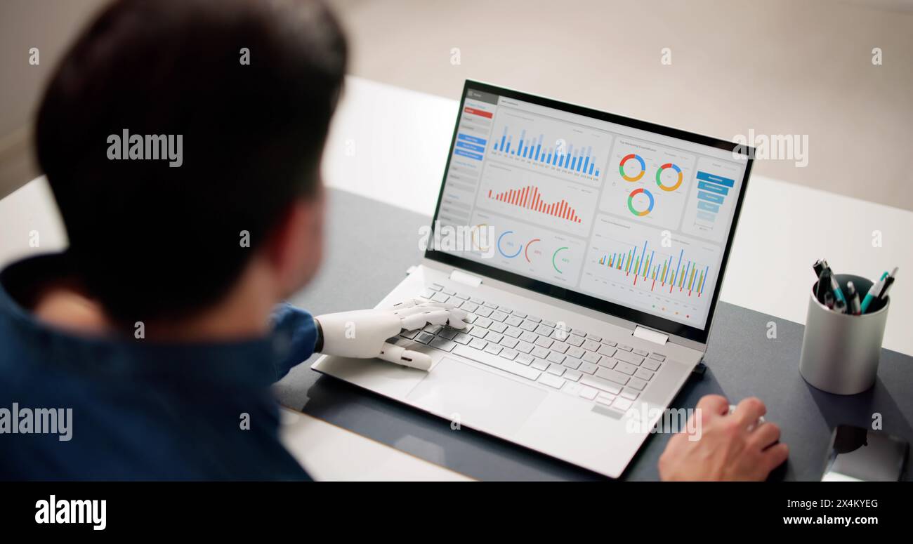 Man With Prosthetic Hand Working On Laptop. Artificial Limb Stock Photo