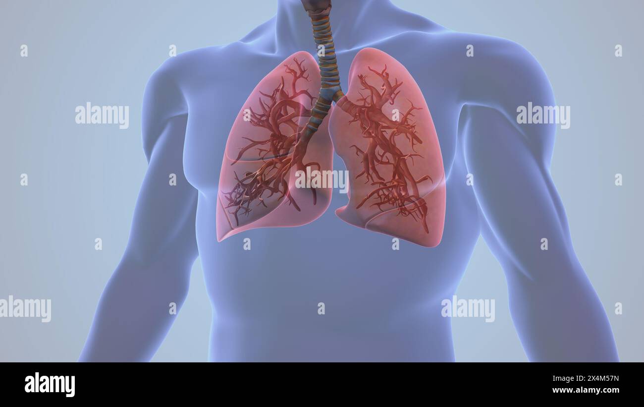 Human Pleurisy Lung Inflammation Pain Stock Photo