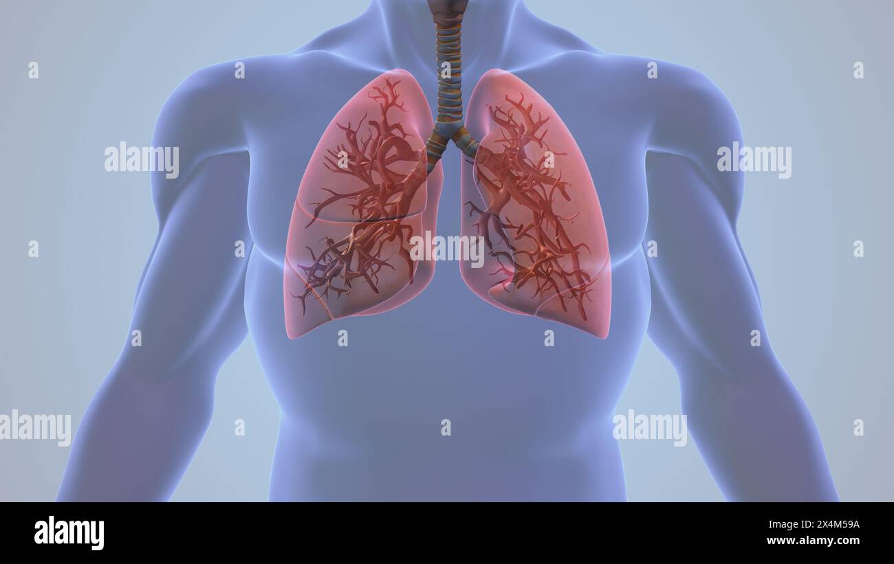 Human Pleurisy Lung Inflammation Pain Stock Photo