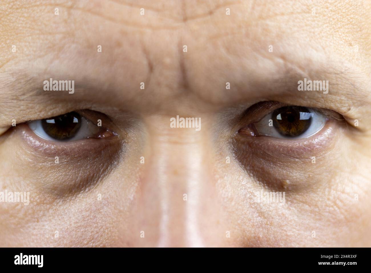 This image captures the deepset, brown eyes of a 45yearold man. The