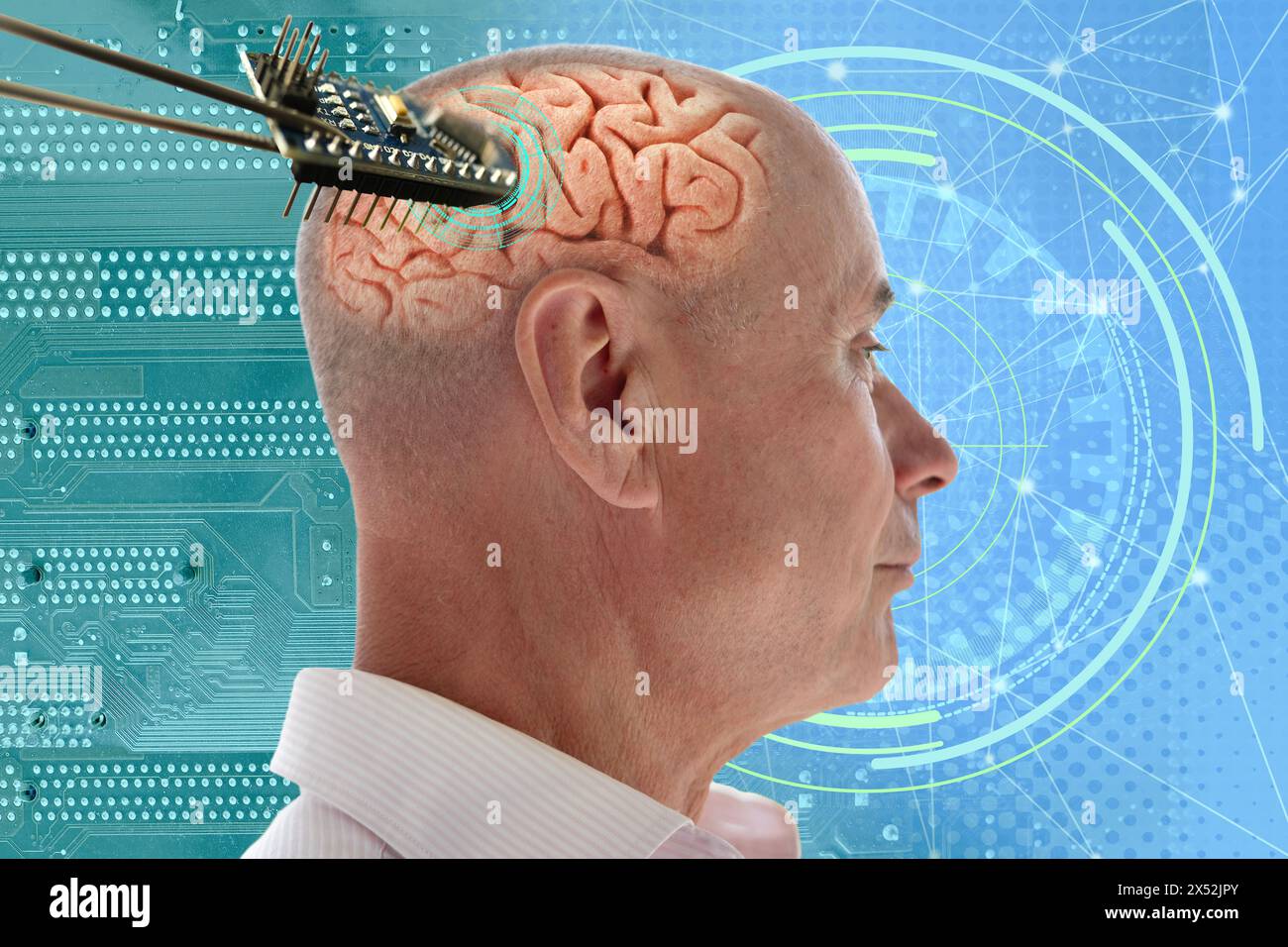 Installing electronic chip into human brain, applied in various fields neurotechnology and medical science, cutting-edge technology, restore sight Stock Photo