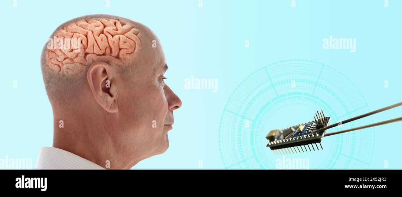 Installing electronic chip into human brain, applied in various fields neurotechnology and medical science, computer control person Stock Photo