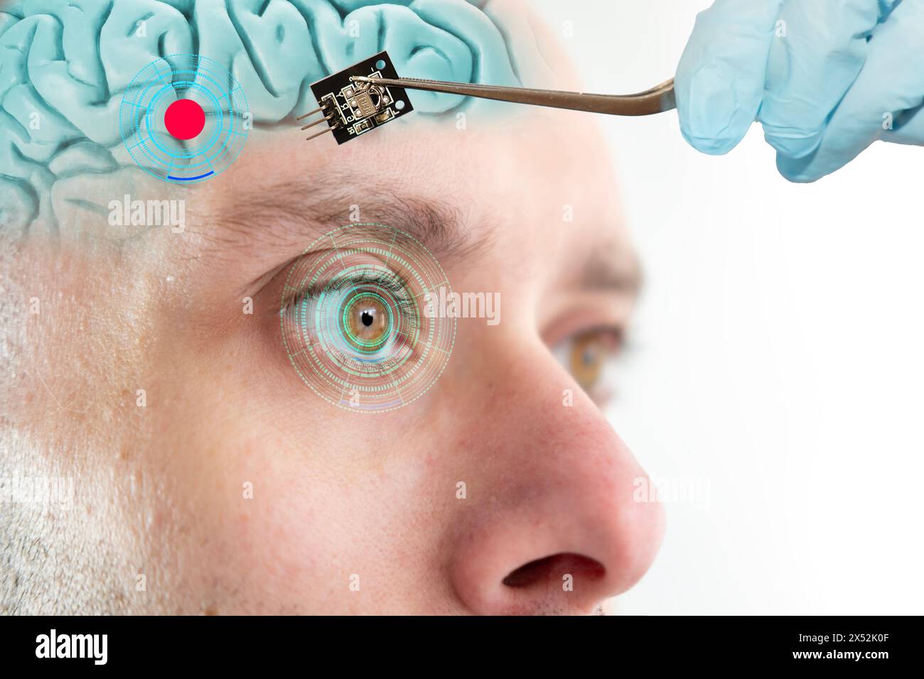 Installing electronic chip into human brain, applied in various fields