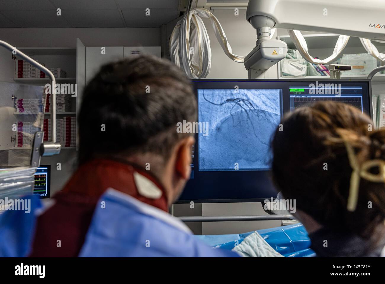 Denizli Turkey-28 February 2024; Doctors conduct a diagnostic operation.Coronarography.Percutaneous coronary intervention-recanalization, balloon angi Stock Photo