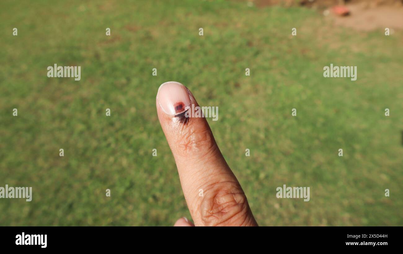 Indian voter voted in election. Ink-marked nail pointer on index finger, right for democracy Stock Photo